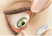 Silmapanemine Silmapanemine